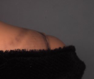 Teresa's Staining